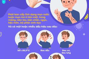 TP Hồ Chí Minh phát hiện thêm ca đậu mùa khỉ thứ 5